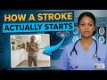 What a Stroke Looks Like the Day Before It Hits — Know This to Protect Yourself | Dr. Favor