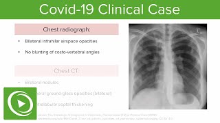 COVID-19 Clinical Case | Lecturio