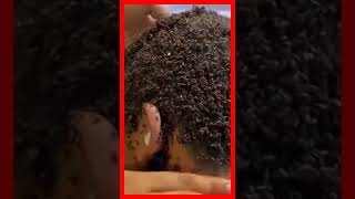 Clearing Many Lice l Head Lice Removal   4 Resimi