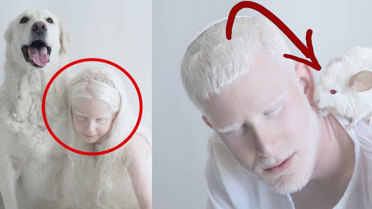 TOP 5 PERSONAS ALBINAS NO VAS A CREER QUE EXISTEN | Tops -