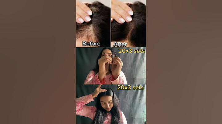 Exercises for Hair Growth #exercise #shorts #hairgrowth