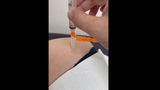 Trochanteric Bursa Injection