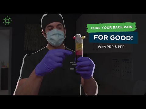 How to Cure Back Pain for Good! Platelet Rich Plasma (PRP) Injections with Ed Bozzo, San Remo Bakery