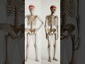 30 Days of Gym vs 30 Days of Excuses — Who Wins in the End? #skeleton #ai #animation #shorts