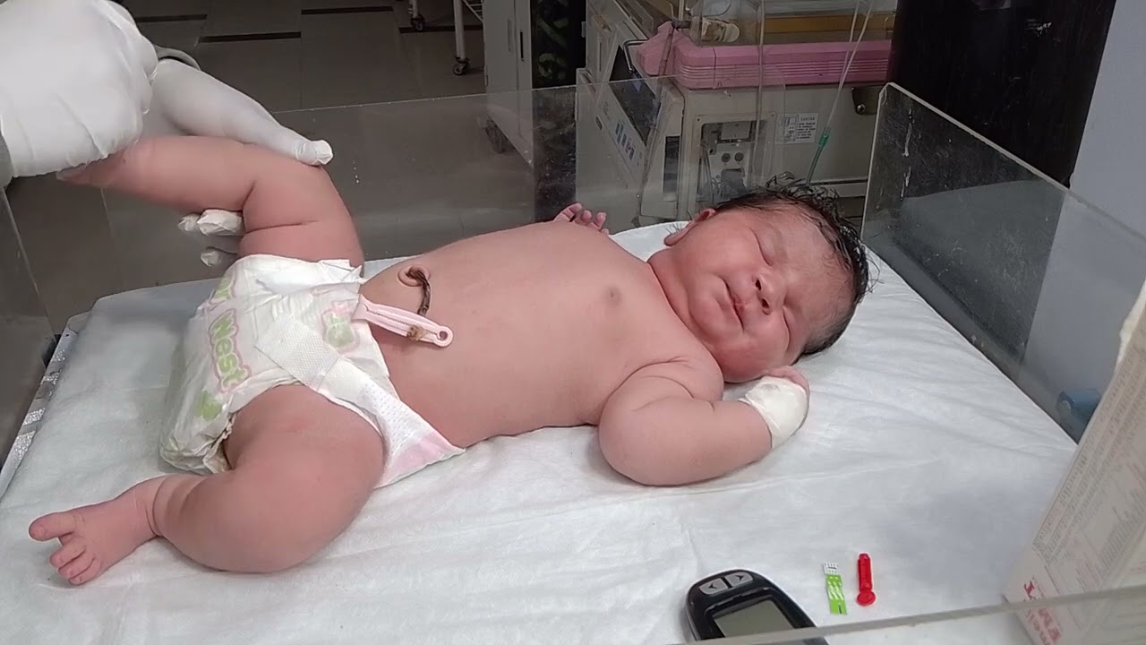 Day-67 baby treatment🩺😷.!#aiims#nicu#hospital#medicallife#newbornbaby#cutebaby#treatment#shortsfeed