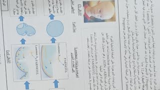 حل موضوع رائع لحالة مرضية نادرة ( الشيخوخة المبكرة ) من مجلة أحمد بوالريش