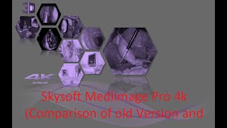 Skysoft Mediimage Pro 4k (Comparison of old Version and new Version) screenshot 2