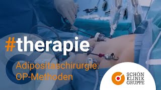 Adipositaschirurgie – Die OP-Methoden | Schön Klinik Hamburg Eilbek