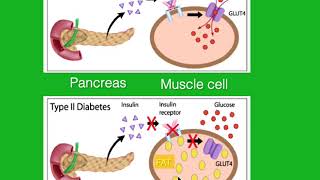 DAROGA Gestational Diabetes Part One
