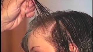 Removing Head Lice Safely (Arabic)  إزالة قمل الرأس بطريقة آمنة