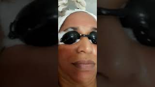 Mnrf Treatment  Midas Aesthetic Clinic