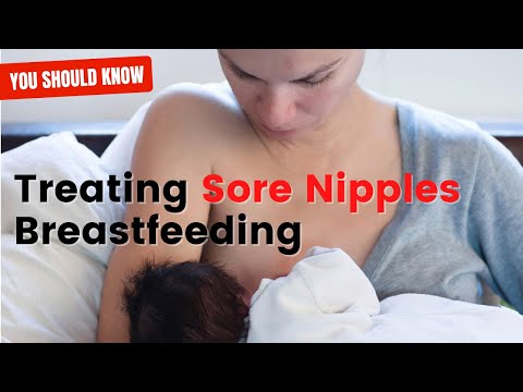 Treating Sore Nipples While Breastfeeding I Some Tips