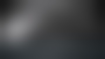 Right Laparoscopic Donor Nephrectomy  Tips and Tricks -Dr Pragnesh Desai