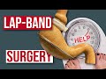 Can You Lose Weight With The Lap Band Surgery?