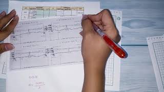 Three Wire Leveling
