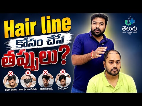 Hair line కోసం తప్పులు చేసే తప్పులు⚠️🔥🔥🔥