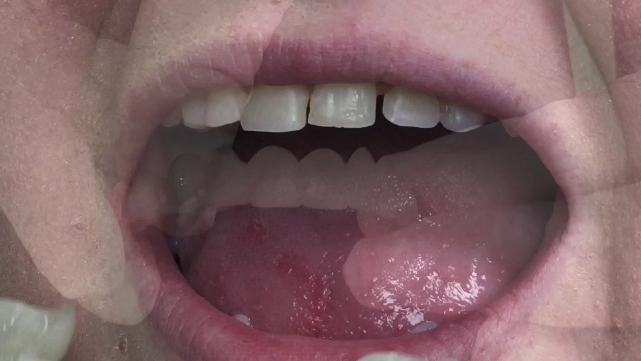 Houston Cosmetic Dentist...How to make small teeth look bigger without