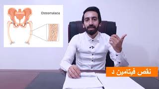 أعراض نقص فيتامين د علي العظام و العضلات