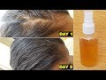 வெந்தய ஸ்பிரே | Thin Hair to Thick Hair in 1 Week | Fenugreek  Hair Spray