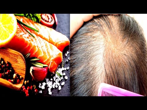 Eat These Foods To Regrow Hair In 3 Days, Hair Loss Treatment - Hair Loss Cure!