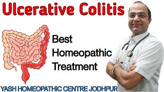 Ulcerative Colitis treatment ।IBS ।stomach pain।blood mucus in stool homeopathy Treatment screenshot 5