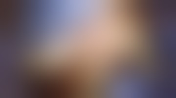 Reconstructie van chronische proximale hamstringruptuur met achillespeestransplantaat: HAMMER-chi...