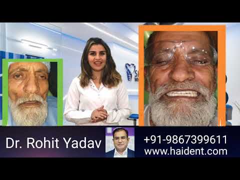 اسعار زراعة الاسنان الفورية زراعة الاسنان في الهند تجربتي في زراعة الاسنان في تركيا في الهند