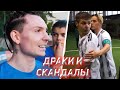 АМКАЛ, 2DROTS - СТЫЧКИ И СКАНДАЛЫ