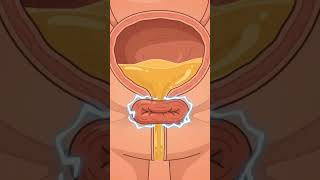 Don't Hold Your Pee! Here's Why 🚽 #drwhy #humanbody #healthfacts #shorts