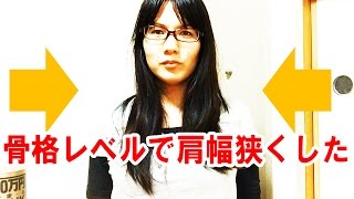 Gid Mtf 手術せずに肩幅を狭くする施術があるので受けてみた結果 スザンヌみさき公式ブログ