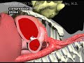 CPR Chest Compression Physiology Animation by Cal Shipley, M.D.