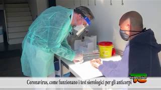 Coronavirus, come funzionano i test sierologici per gli anticorpi 22.04.2020