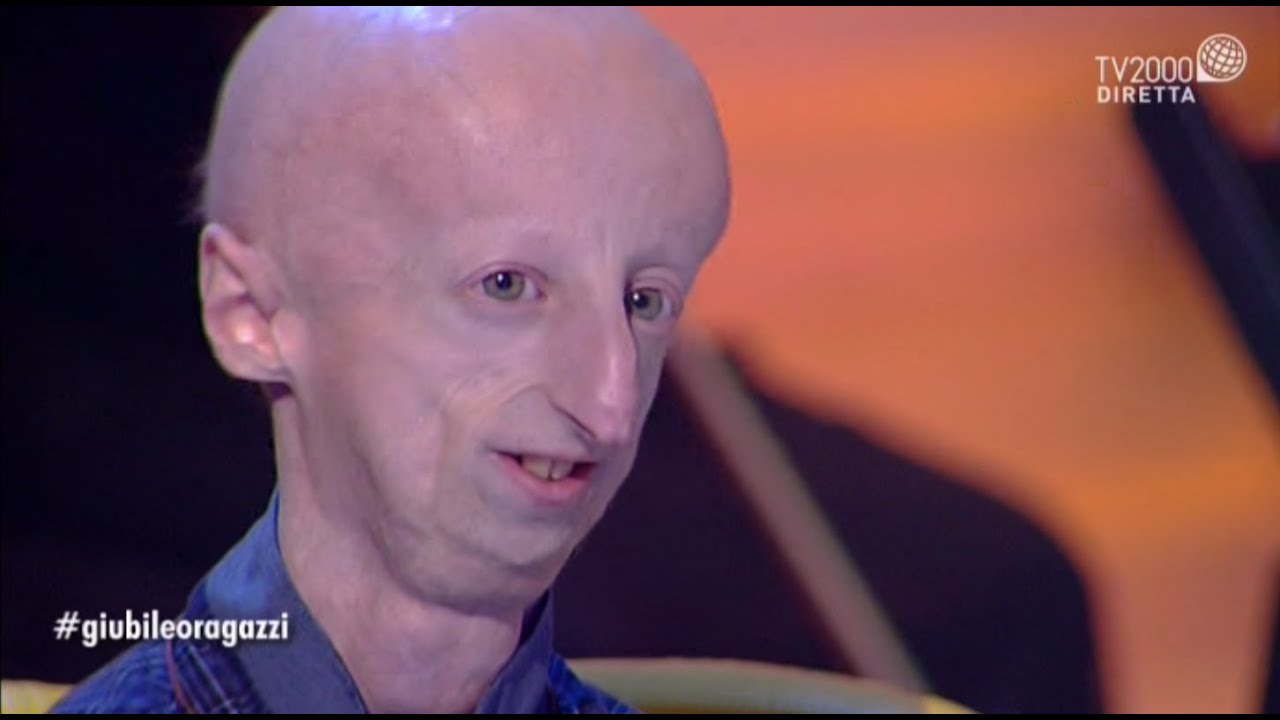 #GiubileoRagazzi La testimonianza di Sammy Basso e dei suoi genitori