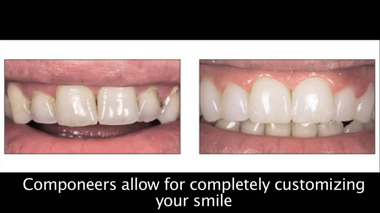 Coltene Whaledent, inc