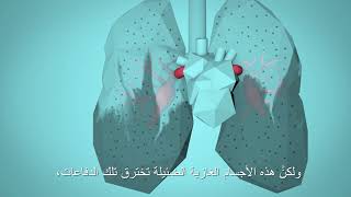 منظمة الصحة العالمية: تنفس الحياة (BreatheLife) - كيف يؤثر تلوّث الهواء على جسمك