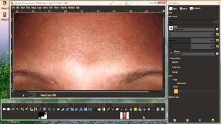 Removing facial pimples in gimp using the cloning tool