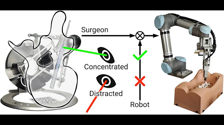 Visual Attention Based Cognitive Human–Robot Collaboration for Orthopedic Surgery