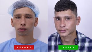 Indian Man's unbelievable face transformation