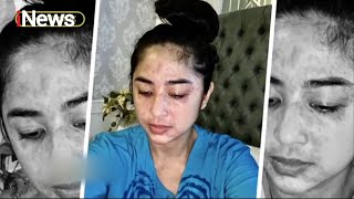 Cerita Perjuangan Dewi Perssik saat Alami Gejala COVID-19 - iSeleb 28/12