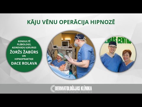 Kāju vēnu operācija hipnozē