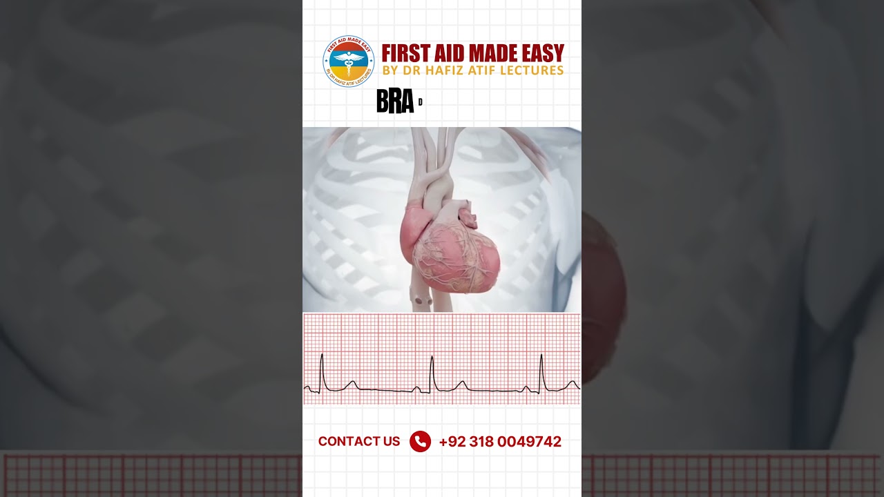 ECG MADE EASY BY FIRST AID MADE EASY PLATFORM | First Aid Made Easy Platform #drhafizatif