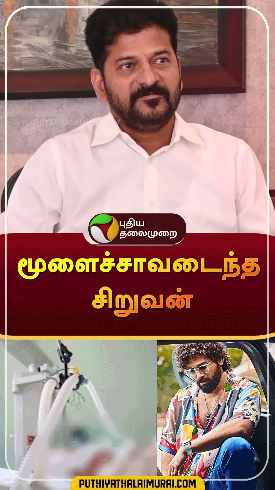 மூளைச்சாவடைந்த சிறுவன் | #shorts | #pushpa2