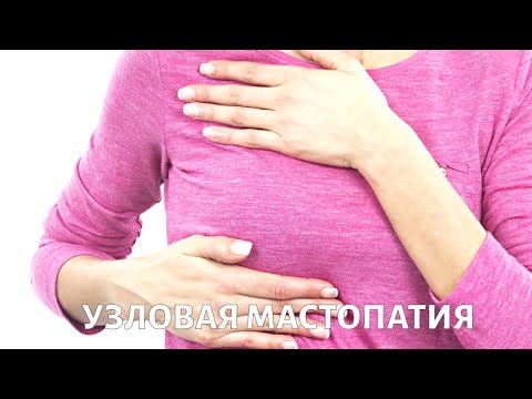 Узловая МАСТОПАТИЯ молочной железы: диагностика и лечение