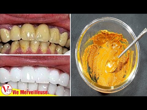 Vidéo: Blanchiment Des Dents Au Curcuma: Huile De Noix De Coco, Résultats, Recette Et Plus