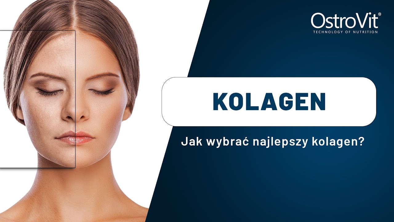 kolagen-na-stawy-i-nie-tylko-jak-wybra-najmocniejszy-ostrovit