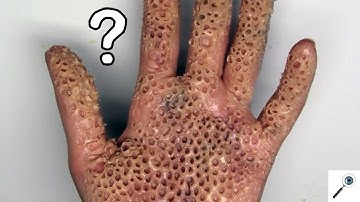 3 Strange Phobias You Didn
