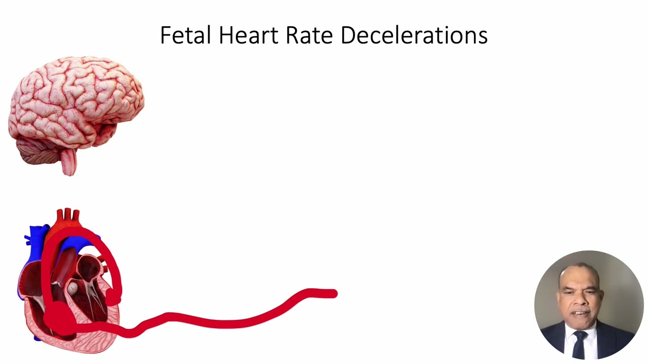 Implementation of International Expert Consensus Statement on Physiiological Interpretation of CTG