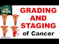 NEOPLASIA Part 11: GRADING and STAGING of cancer