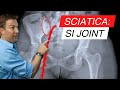 Sciatica and SI Joint Dysfunction: The Surprising Connection &amp; Simple Solutions Revealed!