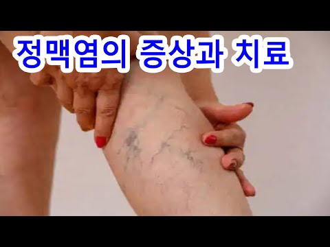정맥염의 증상과 <strong>치료</strong>